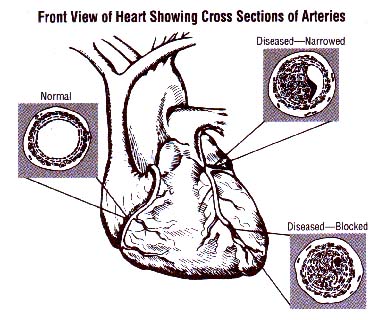 heart, with cross sections of arteries