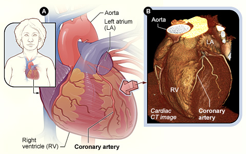 cardiac CT imaging