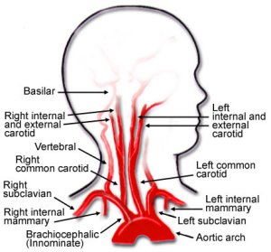 carotid arteries