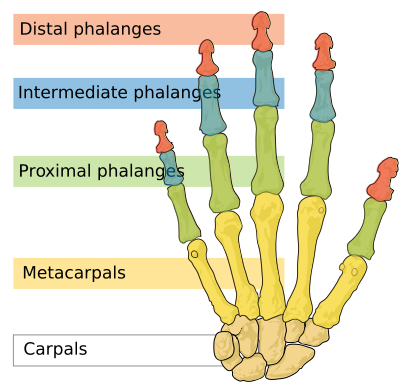 bones of the hand cast