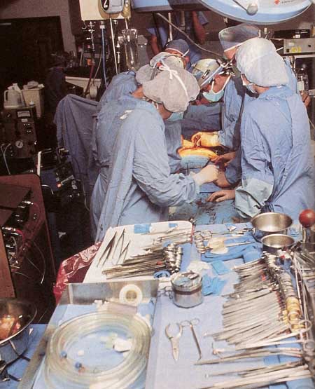 heart transplant surgery