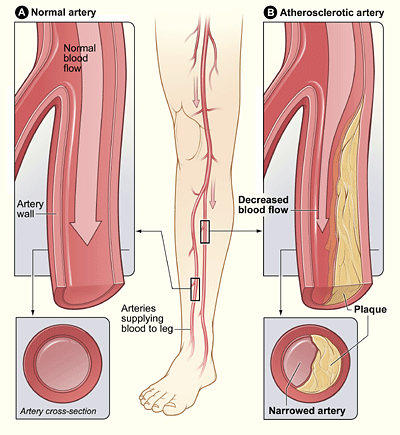 location of leg arteries