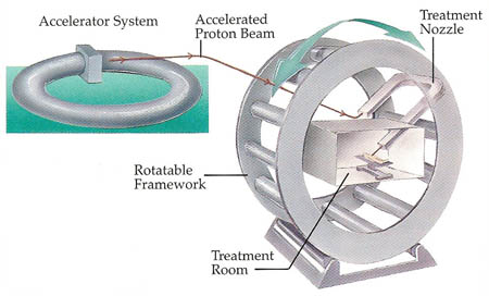 proton accelerator for cancer treatment