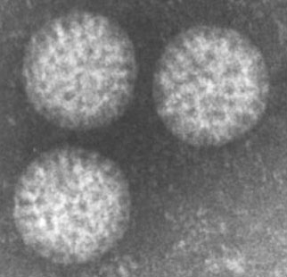 electron micrograph of rotavirus virions