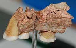 Kents Cavern teeth
