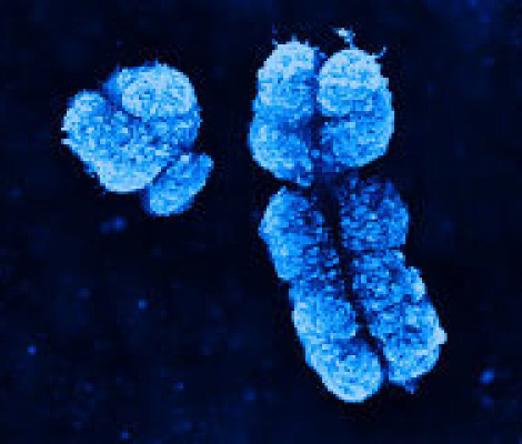 Human X- (right) and Y- (left) chromsomes