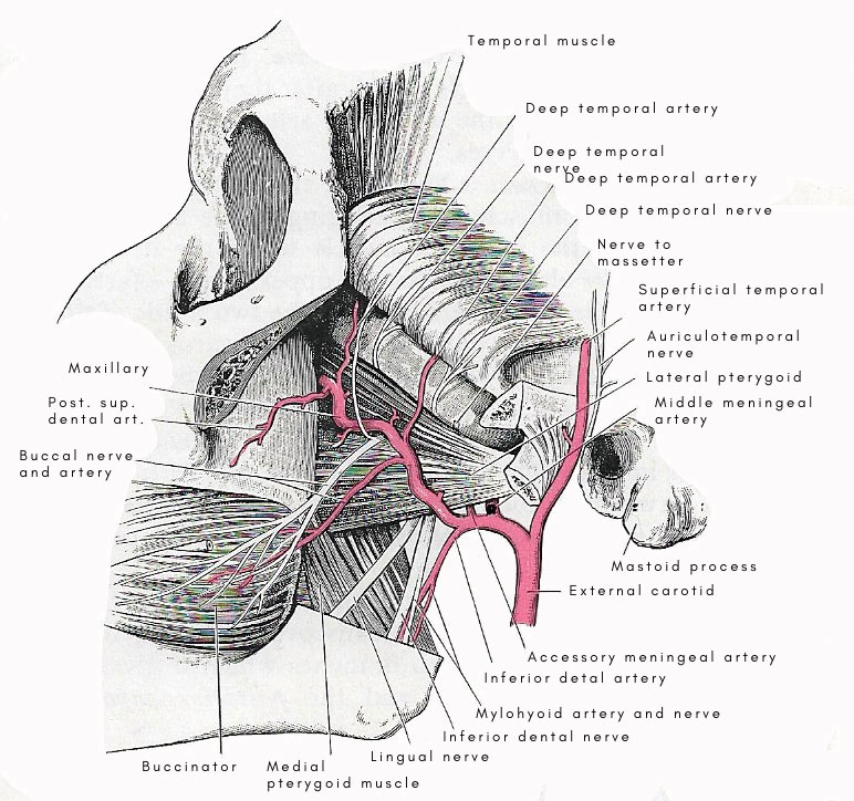 Infratemporal_fossa_dissection