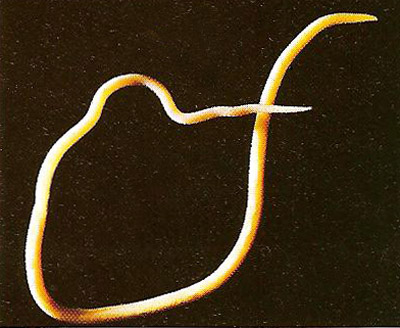 Ascaris lumbricoides