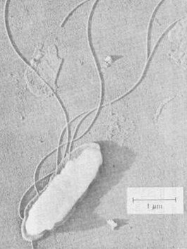 Desulfotomaculum nigrificans