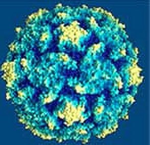 Epstein-Barr virus