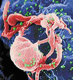 Scanning electron micrograph of HIV-1, colored green, budding from a cultured lymphocyte