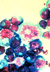 HIV-infected 
            T-cells