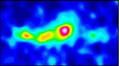 radio map of the core of the Shapley Concentration