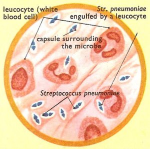 Streptococcus pneumoniae