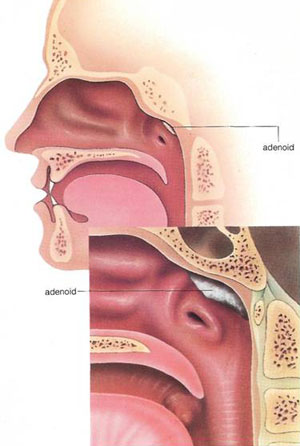 location of adenoid