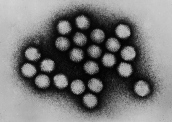 transmission electron micrograph of an adenovirus