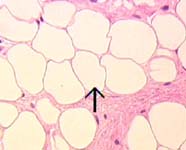 adipose tissue