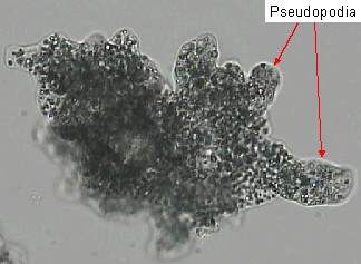 ameoba with pseudopodia