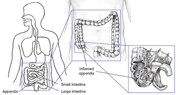 appendix