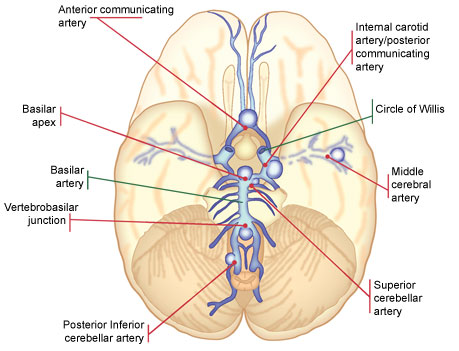 arteries supplying the brain