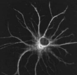 Rat brain astrocyte in culture, 
            stained by immunofluorescence