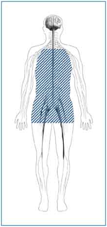 autonomic neuropathy