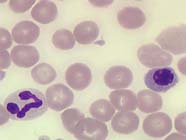 red and white blood cells