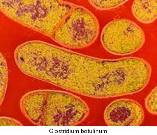 Clostridium botulinum