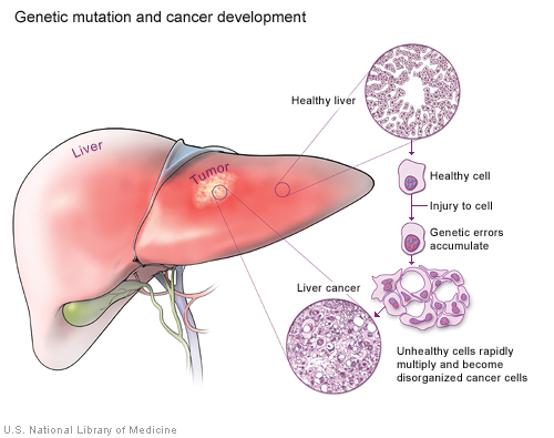 how cancer starts