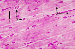 cardiac muscle