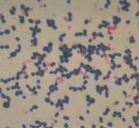 Gram positive cocci