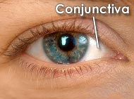 conjunctiva