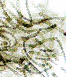 cyanobacteria