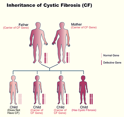 cystic fibrosis inheritance