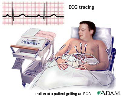 electrocardiogram