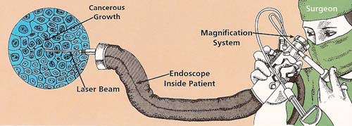 using an endoscope