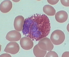 eosinophil