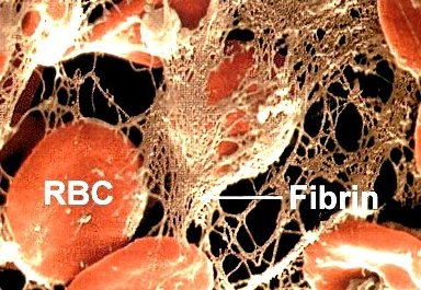 fibrin