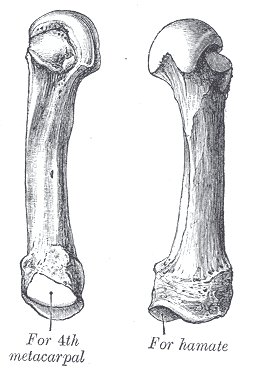 fifth metacarpal