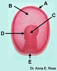 gastrula