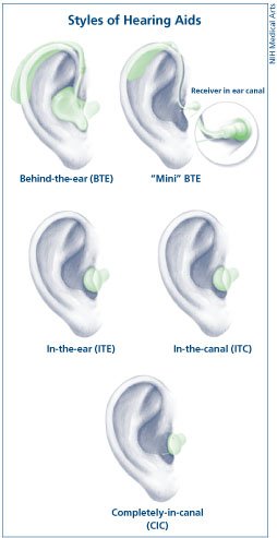types of hearing aid