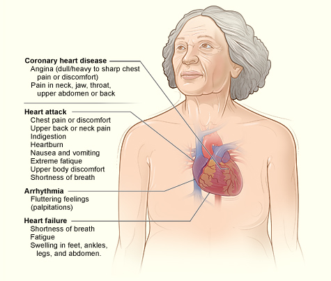 Major signs an dsymptoms of coronary heart disease.