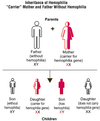 Inheritance of hemophilia, mother carrier, father without hemophilia