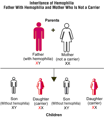 Inheritance of hemophilia, father with hemophilia, mother not a carrier