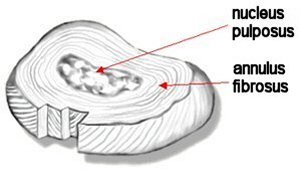 intervertebral disk