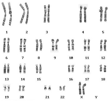 normal female karyotype
