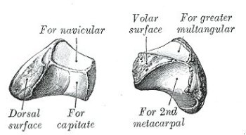 left lesser multangular bone