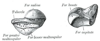 left navicular bone