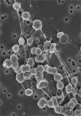 methanogens