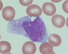 monocyte